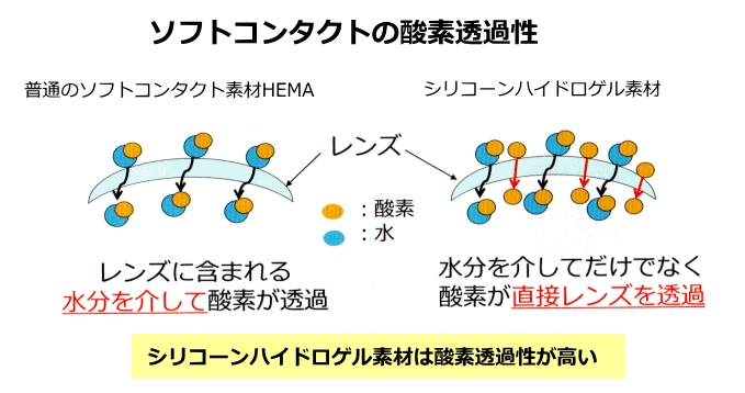 酸素透過性の高いシリコンハイドロゲル素材